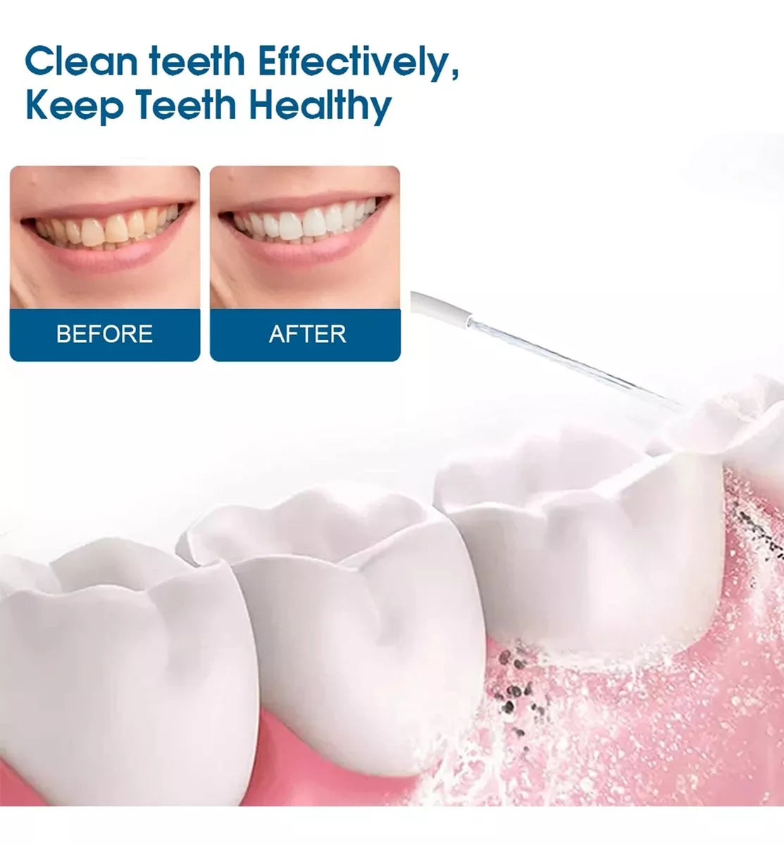 Irrigador Oral Recargable 4 BOQUILLAS