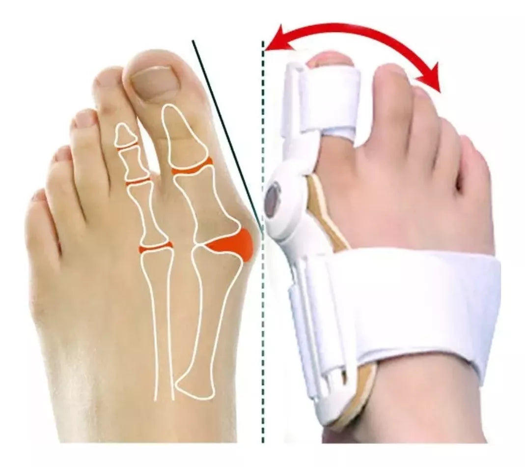 Férula Corrector de Juanete – Alivio Cómodo y Efectivo para tus Pies