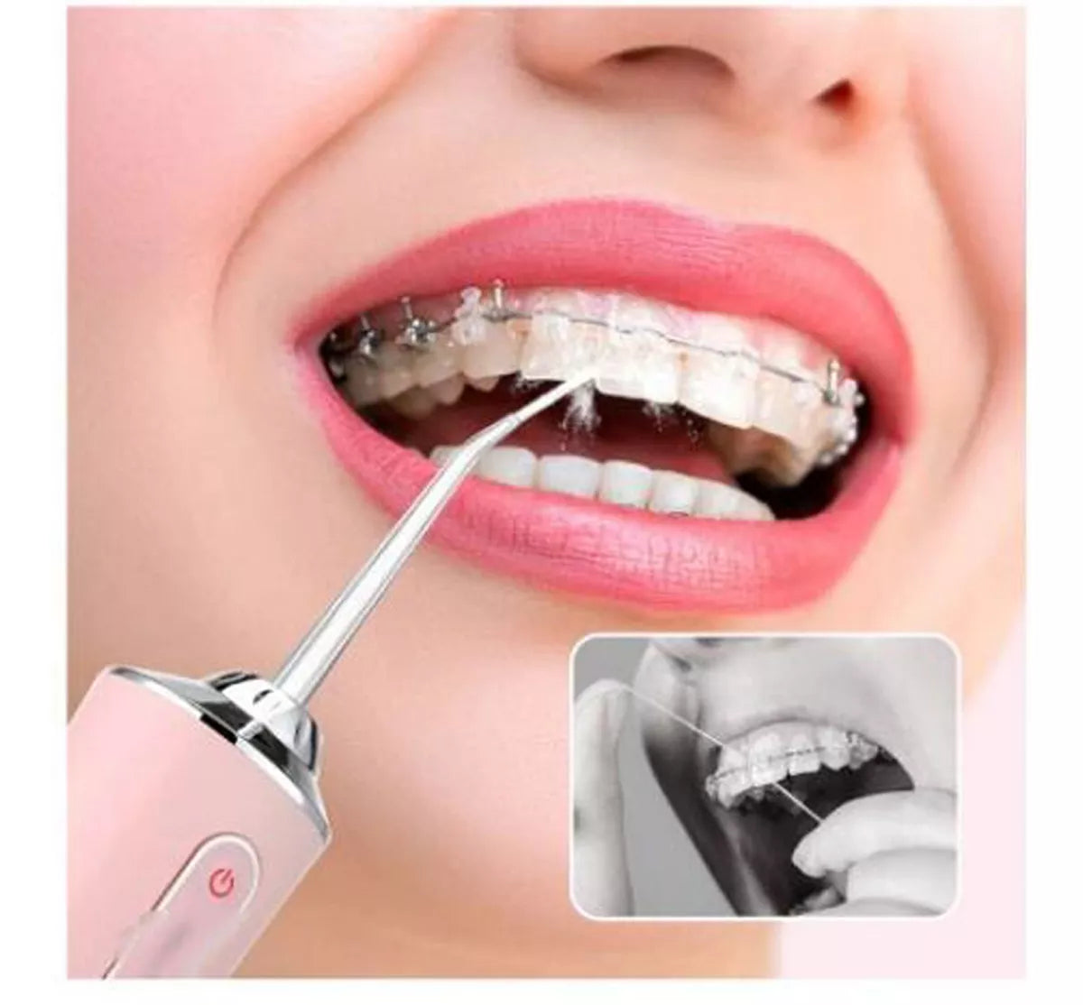 Irrigador Oral Recargable 4 BOQUILLAS